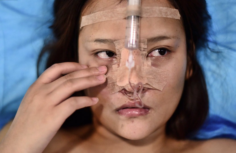 Những cô gái đập mặt xây lại ở Trung Quốc: Đời sang trang nhờ diện mạo mới đến nỗi xem bác sĩ thẩm mỹ là cha mẹ thứ 2 - Ảnh 3.