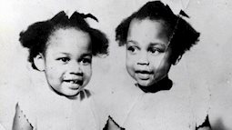 Câu chuyện rùng rợn về 'cặp song sinh câm lặng' bí ẩn nhất thế giới với những thói lập dị đáng sợ, một người sống bình thường thì người kia phải chết