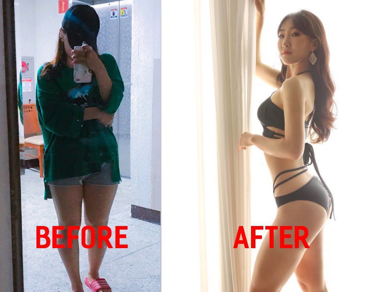 Những màn Before - After 