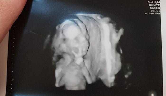 Chụp ảnh siêu âm mà giơ tay chào đủ kiểu, em bé từ trong bụng mẹ đã được dự đoán tương lai sau này vô cùng xán lạn - Ảnh 2.