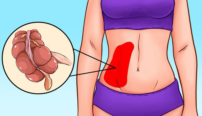 Những kiểu đau bất thường ở vùng bụng cảnh báo vấn đề sức khỏe bạn dễ gặp phải - Ảnh 1.