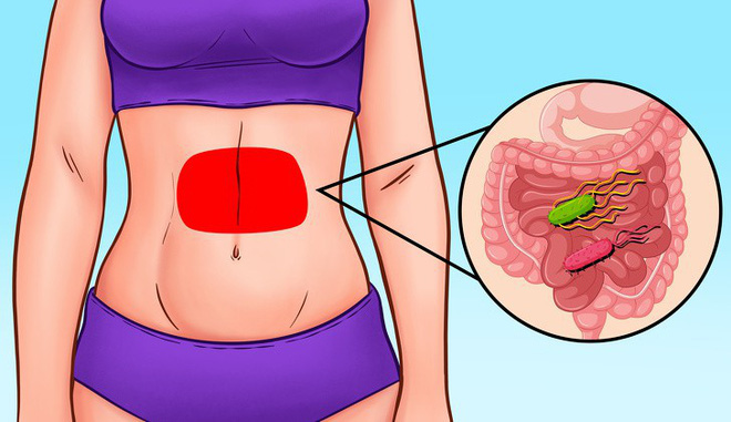 Những kiểu đau bất thường ở vùng bụng cảnh báo vấn đề sức khỏe bạn dễ gặp phải - Ảnh 4.