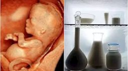 Mẹ bầu mang thai được 28 tuần thì chết lưu, thủ phạm không ai ngờ là do hộp sữa đặt trong tủ lạnh
