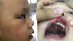 Lá thư xin lỗi gửi lúc đêm muộn của cô giáo ở Hà Nội tát bé hơn 2 tuổi sấp mặt, tụ máu môi