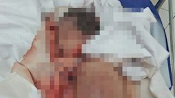Thông tin chính thức vụ trẻ sơ sinh tử vong với vết đứt quanh cổ: Thai chết lưu 7 ngày trước khi vào bệnh viện