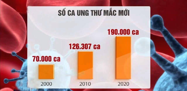 Giám đốc Bệnh viện K Trung ương chỉ ra 9 nguyên tắc ăn uống quan trọng phòng chống ung thư - Ảnh 1.