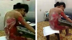 MXH nước ngoài lan truyền hình ảnh người phụ nữ bị bạo hành thương tâm nhưng đó lại là một cô gái Việt Nam và sự thật câu chuyện hoàn toàn khác