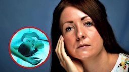 Nghiện tắm nắng nhân tạo, cô gái 25 tuổi phải chật vật để chống chọi với căn bệnh ung thư da