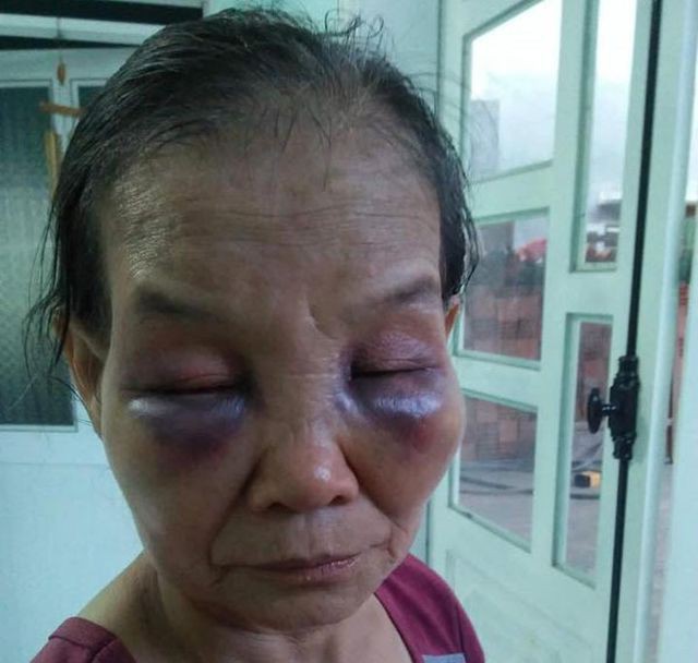 Con dâu đánh mẹ chồng ở Bình Phước bị phạt 2 triệu, tiết lộ thêm câu chuyện - Ảnh 1.