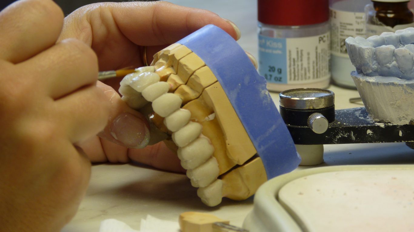 Cái giá của sự đẹp: Cận cảnh quy trình bọc răng sứ khiến người xem cũng phải thót tim - Ảnh 8.