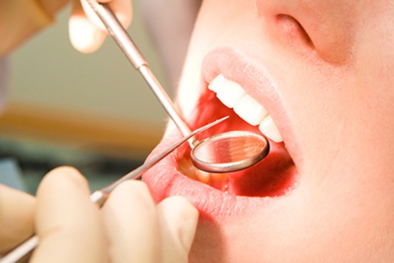 Cái giá của sự đẹp: Cận cảnh quy trình bọc răng sứ khiến người xem cũng phải thót tim - Ảnh 12.