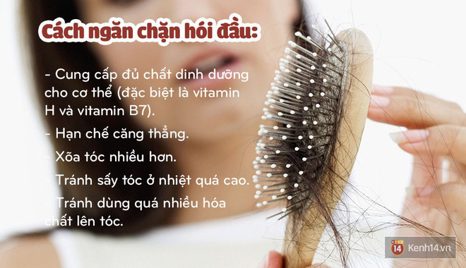 Quốc Trường tiết lộ chăm dưỡng cả tháng trời để chữa hói, và đây là những cách dưỡng giúp mọc tóc bạn có thể thử - Ảnh 5.