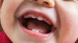 20 bí mật thú vị về những chiếc răng sữa và thứ tự mọc - thay răng của trẻ