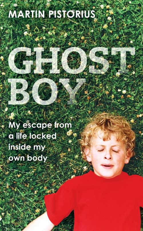 Câu chuyện về ‘Ghost boy’ - cậu bé ma mắc kẹt trong chính cơ thể mình suốt 12 năm trời cùng hành trình miệt mài tìm lại sự sống - Ảnh 8.