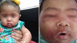 Sau một lần con gái mắc bệnh nhiễm trùng da nghiêm trọng, người mẹ này đã quyết định không bao giờ để người khác động vào con mình