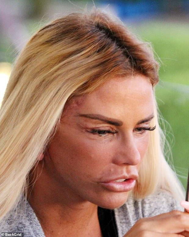 Thảm họa dao kéo hot nhất nước Anh Katie Price: Từng đẹp đến mức Ronaldo mê đắm, bỏ rơi mẹ già ung thư vì nghiện thẩm mỹ - Ảnh 10.