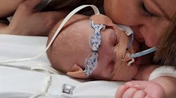 Nhịp tim lên đến 320 nhịp/phút, bé gái 12 ngày tuổi được bác sĩ cấp cứu bằng hành động khiến bố mẹ bàng hoàng