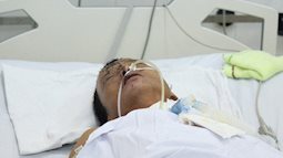 Dấu hiệu bệnh whitmore - căn bệnh do vi khuẩn ăn mòn cơ thể con người, có thể gây tử vong trong vài ngày