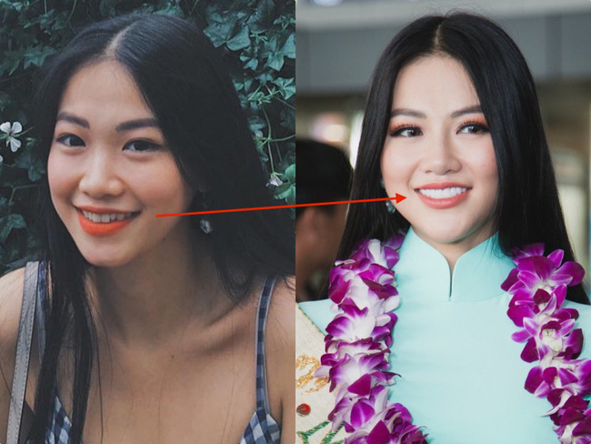 Thừa nhận tiêm thẩm mỹ, nhan sắc của Phương Khánh đã thay đổi thế nào để trở thành Tân Hoa hậu Miss Earth 2018 - Ảnh 10.