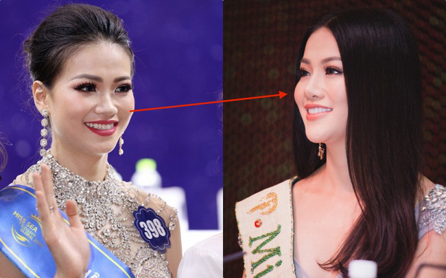 Thừa nhận tiêm thẩm mỹ, nhan sắc của Phương Khánh đã thay đổi thế nào để trở thành Tân Hoa hậu Miss Earth 2018 - Ảnh 8.