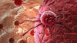 Tìm ra cơ chế khiến bệnh ung thư "né" được hoá trị