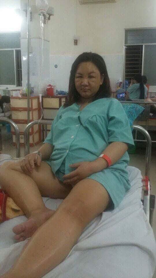 Cô gái Việt xinh đẹp bỗng phù nề khi mang bầu, người quen không nhận ra, vào phòng đẻ bị chê “xúc phạm người nhìn” - Ảnh 1.