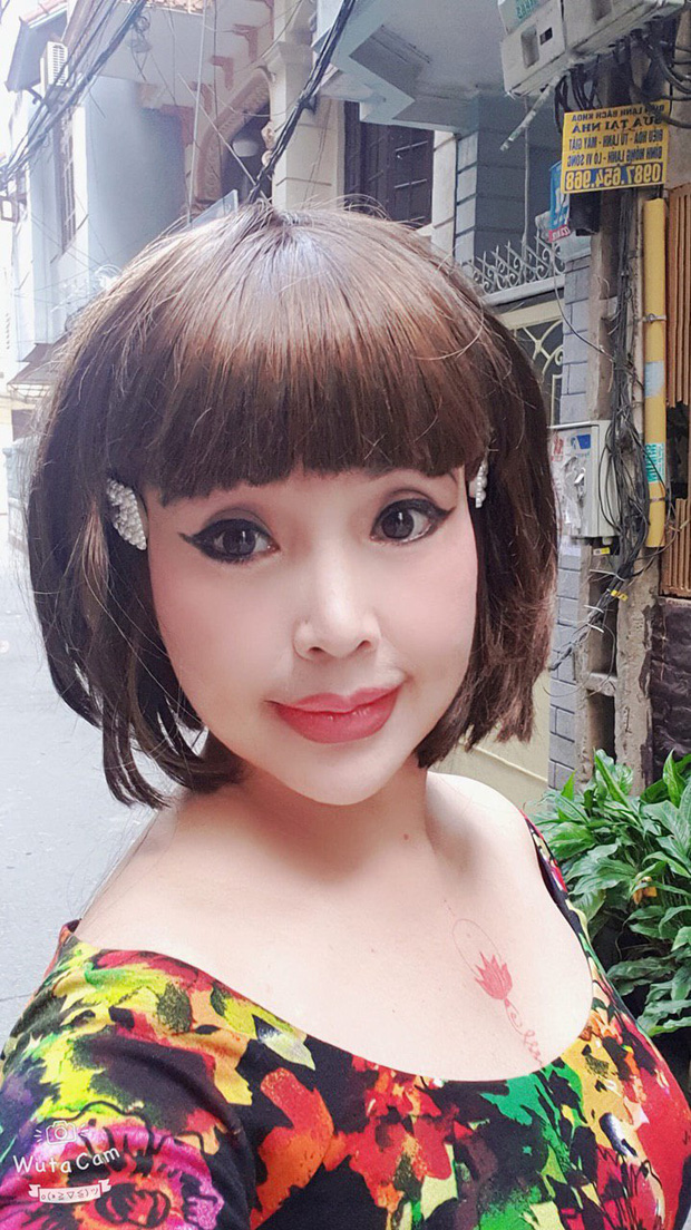 Em bé Hà Nội Lan Hương lộ mặt đơ như tượng sáp, nhưng cuối cùng lần này đã thừa nhận dao kéo - Ảnh 1.
