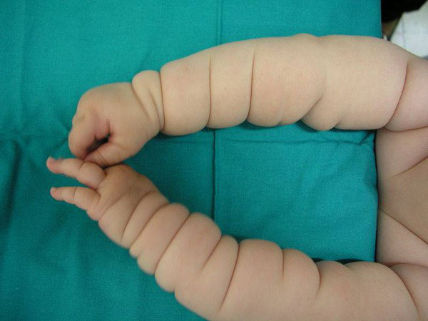 Em bé gây bão MXH với thân hình 