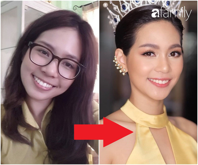Tân Hoa hậu Quốc tế 2019: Xinh đẹp hoàn hảo nhưng hóa ra từng phải nhờ cậy đến thủ thuật “sửa răng” để luôn rạng rỡ - Ảnh 3.