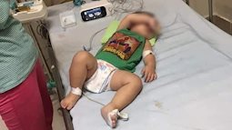 Chuyên gia khẳng định: Chưa có bằng chứng 2 trẻ tử vong do mắc Whitmore lây cho nhau