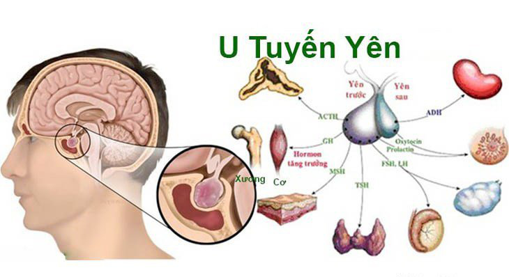 Ngực trai trẻ đột nhiên chảy sữa, bác sĩ cảnh báo căn bệnh ở bộ phận quan trọng đàn ông hay phụ nữ đều có thể mắc - Ảnh 5.