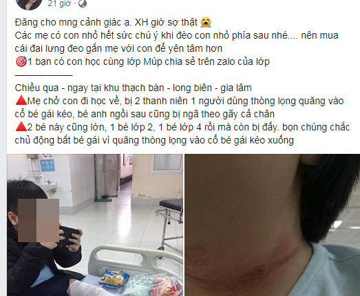 Hà Nội: Sự thật về thông tin 2 cháu bé sau xe mẹ gãy chân vì bị thanh niên thòng dây vào cổ - Ảnh 3.