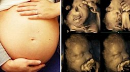 Cảnh báo các bà mẹ: Hóa chất có thể làm tăng nguy cơ con cái sinh ra bị dị tật bẩm sinh