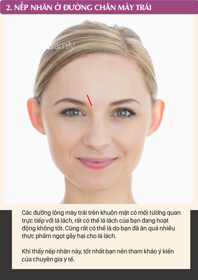Mỗi nếp nhăn trên khuôn mặt gửi một thông điệp về sức khỏe, dưới đây là 10 vị trí nếp nhăn bạn cần nhận ra - Ảnh 2.