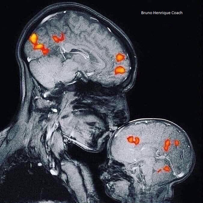 Hình ảnh chụp cộng hưởng từ MRI  thật 100% chứng minh sự lan tỏa yêu thương mạnh mẽ giữa mẹ và con  - Ảnh 1.