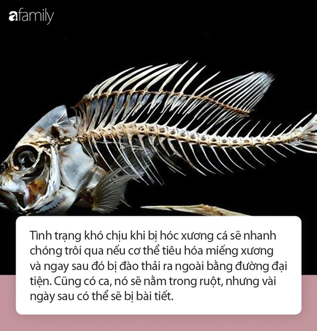 Hóc xương cá đừng có dại mà dùng thứ này chữa bệnh kẻo thiệt thân, hãy dắt túi ngay từng bước sơ cứu dưới đây! - Ảnh 2.