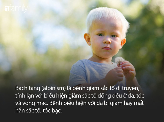 Em bé sinh ra tóc và lông mày đều trắng phau, bác sĩ tiết lộ nguyên nhân khiến cha mẹ bé bàng hoàng - Ảnh 4.