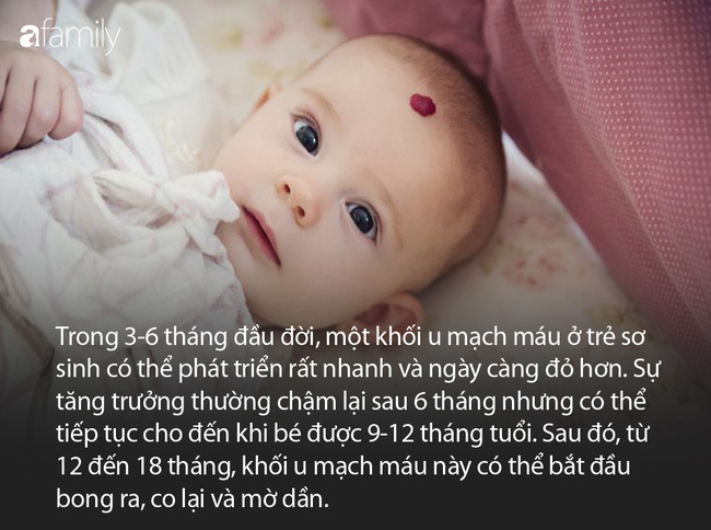 Sự thật về vết bớt dâu tây trên cơ thể trẻ khiến cha mẹ lo lắng khôn nguôi - Ảnh 2.