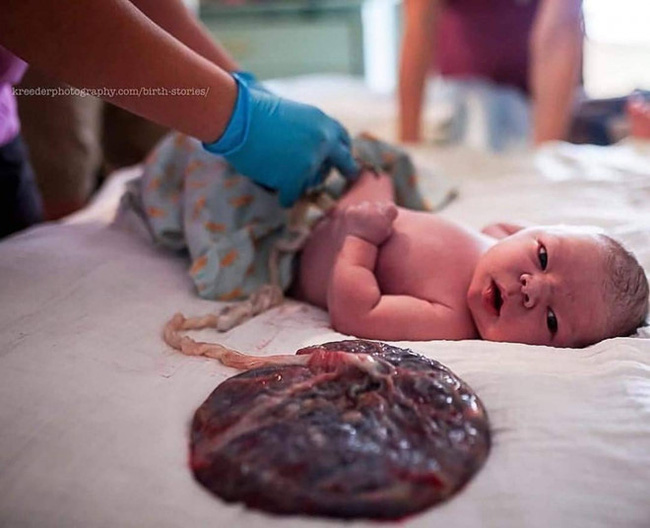Bộ Y tế: Sinh con 'thuận tự nhiên' là phản khoa học, dễ tử vong cả mẹ và bé - Ảnh 3.