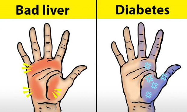 Người có chức năng gan ổn định sẽ không có 4 điểm sau đây trên đôi tay, cùng xem bạn có điểm nào hay không - Ảnh 1.