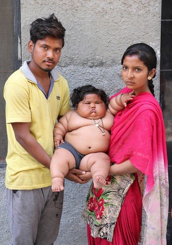 8 tháng tuổi đã gần 20 kg, cuộc sống của bé gái nặng ký nhất Ấn Độ hiện tại như thế nào sau 3 năm phát triển với tốc độ chóng mặt? - Ảnh 3.