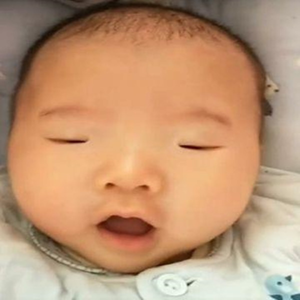 Bé sinh 10 ngày vẫn không chịu mở mắt, nhận kết quả khám của bác sĩ, bố mẹ chỉ biết che miệng cười - Ảnh 2.