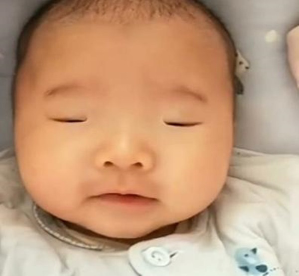 Bé sinh 10 ngày vẫn không chịu mở mắt, nhận kết quả khám của bác sĩ, bố mẹ chỉ biết che miệng cười - Ảnh 3.
