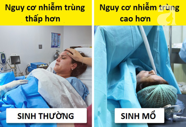 Sinh mổ và toàn bộ những kiến thức cơ bản mẹ cần biết về cuộc đại phẫu: nhiễm trùng, đau đớn, chậm sữa - Ảnh 4.