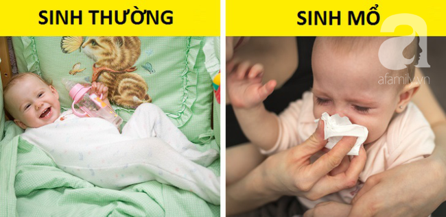 Sinh mổ và toàn bộ những kiến thức cơ bản mẹ cần biết về cuộc đại phẫu: nhiễm trùng, đau đớn, chậm sữa - Ảnh 8.