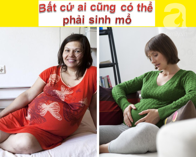 Sinh mổ và toàn bộ những kiến thức cơ bản mẹ cần biết về cuộc đại phẫu: nhiễm trùng, đau đớn, chậm sữa - Ảnh 1.