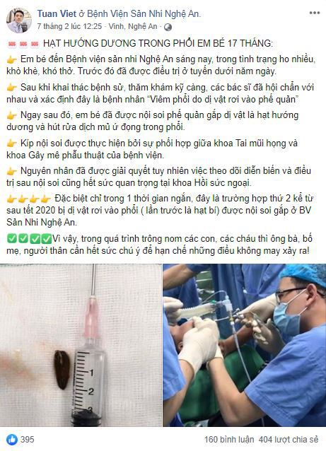 Bé 17 tháng tuổi ho nhiều, khó thở và được bác sĩ gắp ra dị vật đáng sợ trong phổi, ai nhìn cũng bàng hoàng - Ảnh 1.