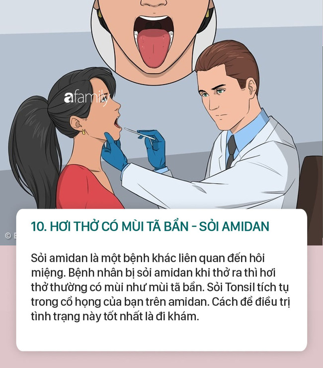 Người bị bệnh gan, thận, ung thư phổi, ung thư dạ dày, bệnh tiểu đường... thì hơi thở thường có mùi như thế này - Ảnh 10.