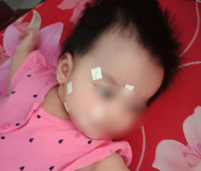 Bé 4 tháng tuổi ở Đồng Nai bị liệt dây thần kinh số 7 vì ra vào phòng điều hoà đột ngột và những lưu ý cha mẹ cần nhớ - Ảnh 1.