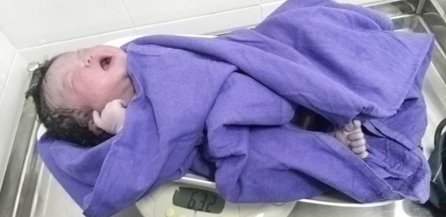 Sinh mổ lần 3, sản phụ Quảng Ninh đón con chào đời nặng 6,1kg - Ảnh 3.